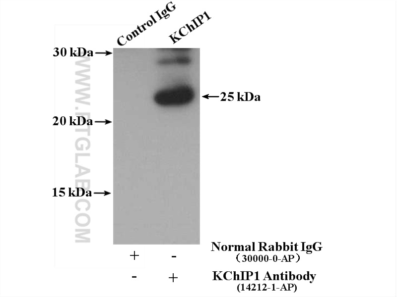 IP experiment of fetal human brain using 14212-1-AP