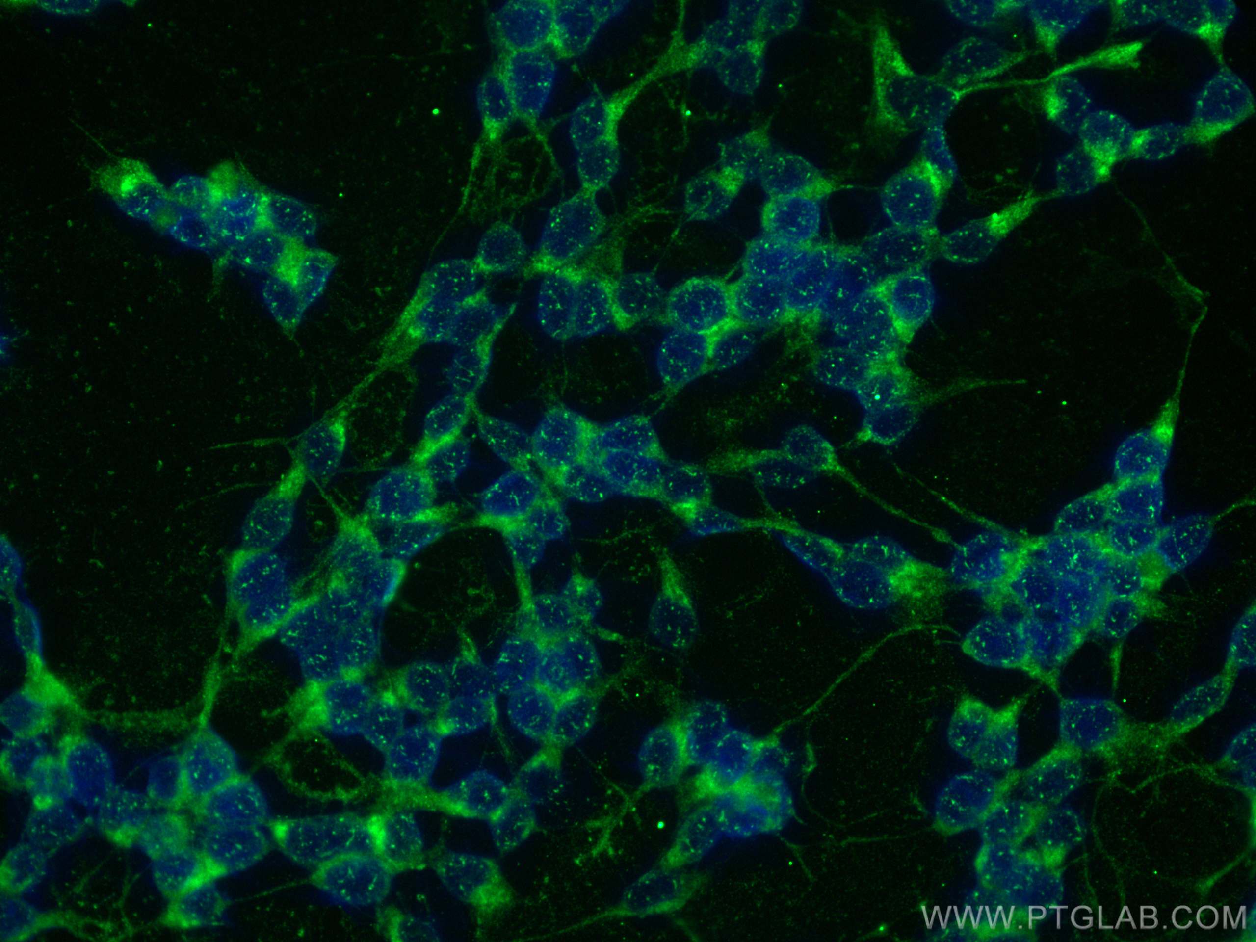 IF Staining of SH-SY5Y using 12032-1-AP