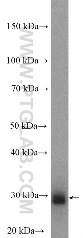 WB analysis of rat brain using 13748-1-AP