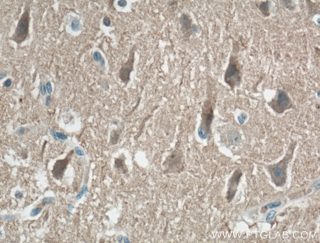 IHC staining of human brain using 60133-1-Ig