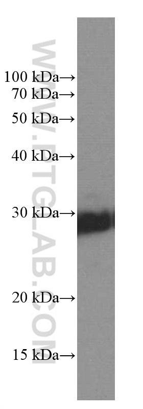 WB analysis of pig brain using 60133-1-Ig