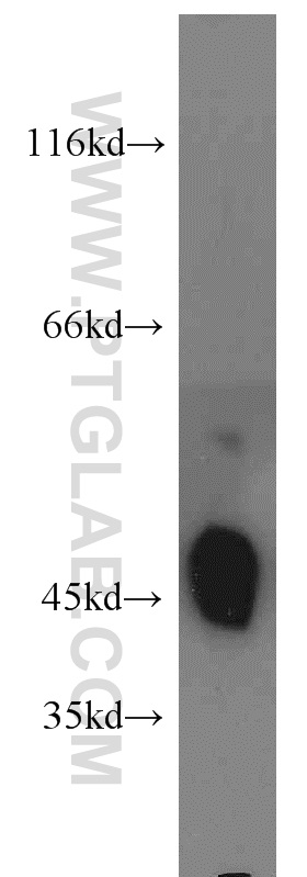 WB analysis of mouse lung using 14135-1-AP