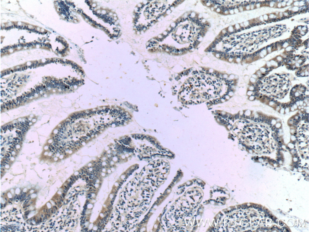 IHC staining of human small intestine using 12657-1-AP