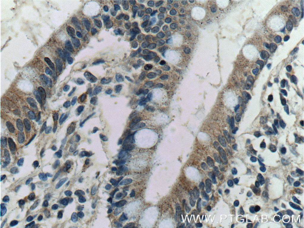 IHC staining of human small intestine using 12657-1-AP