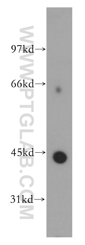 WB analysis of human brain using 12657-1-AP