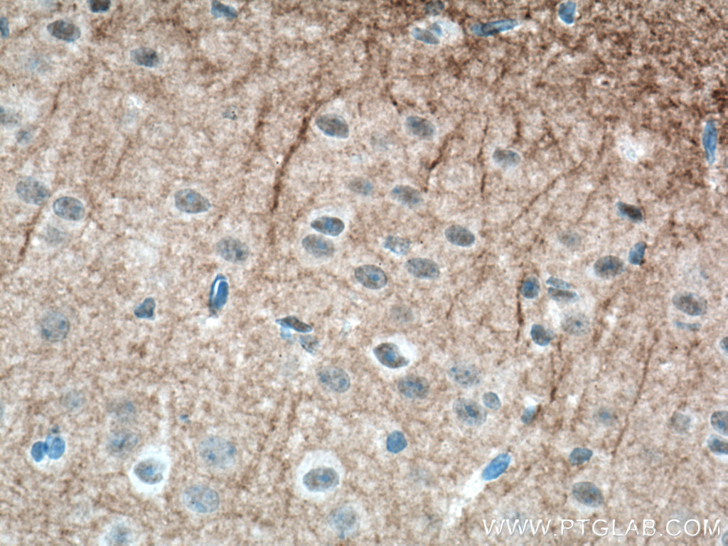 IHC staining of mouse brain using 21647-1-AP