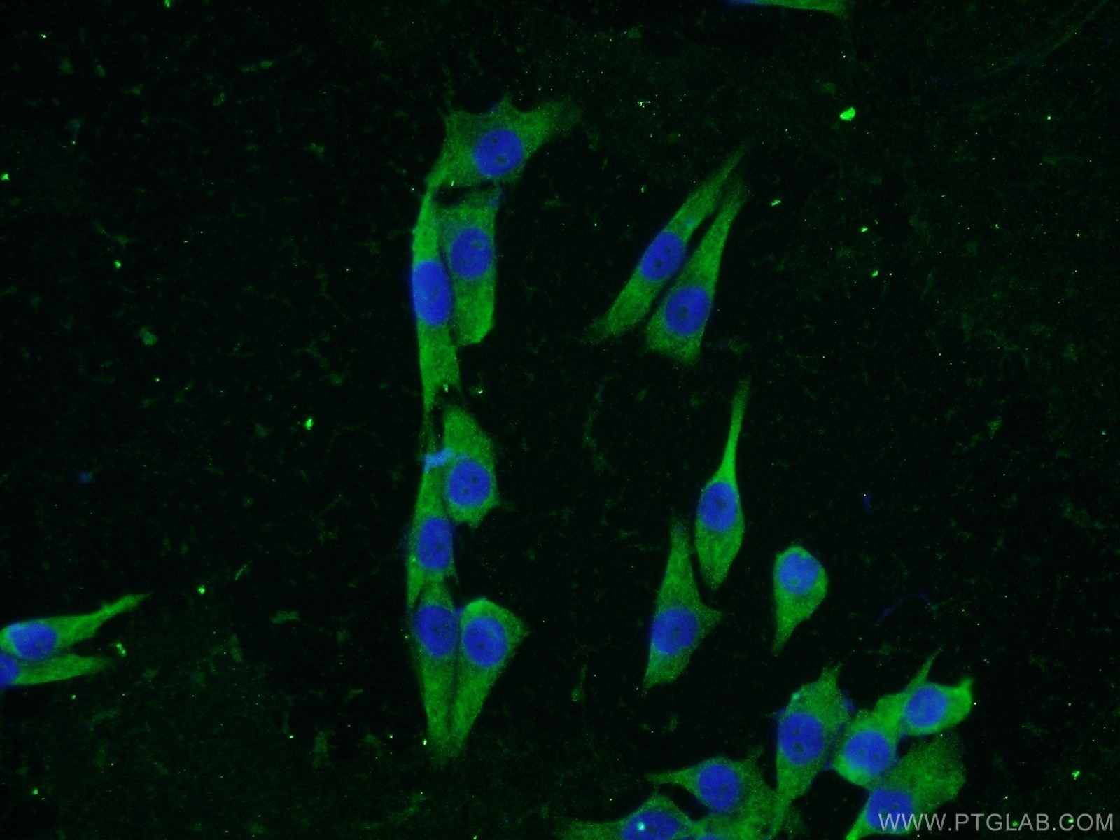 IF Staining of A375 using 23712-1-AP