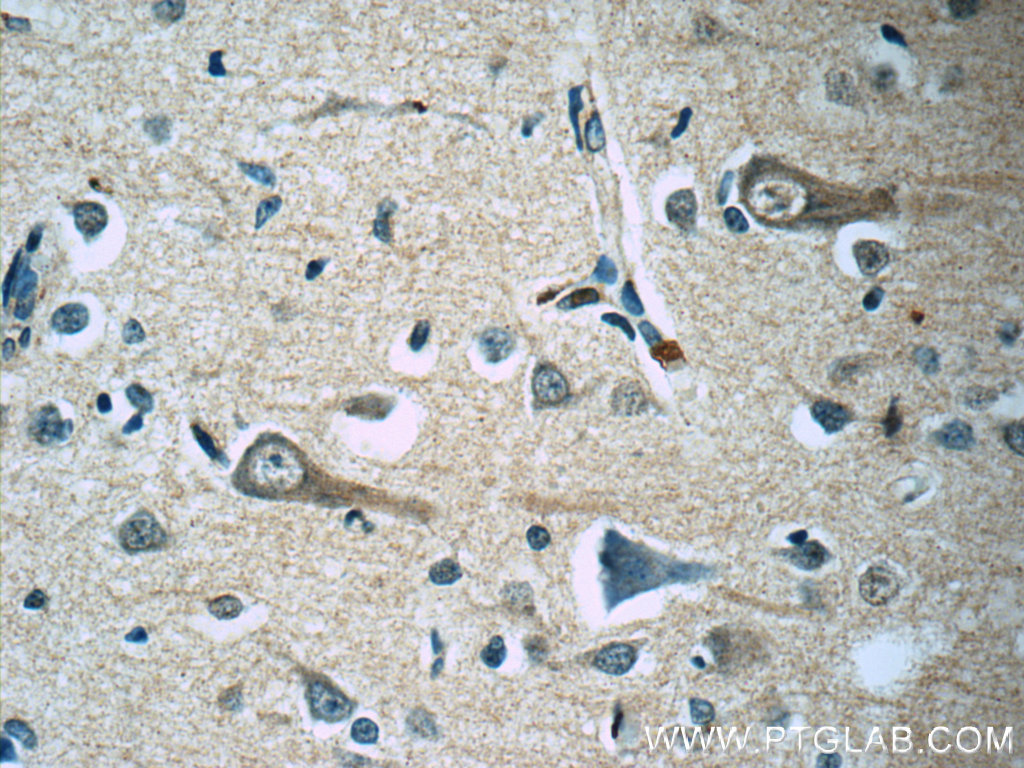 IHC staining of human brain using 60122-1-Ig