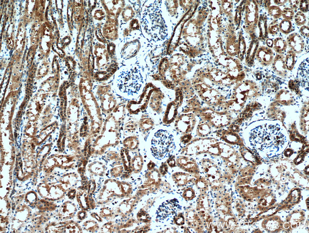 IHC staining of human kidney using 21233-1-AP