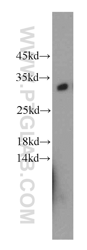 WB analysis of mouse skeletal muscle using 21111-1-AP