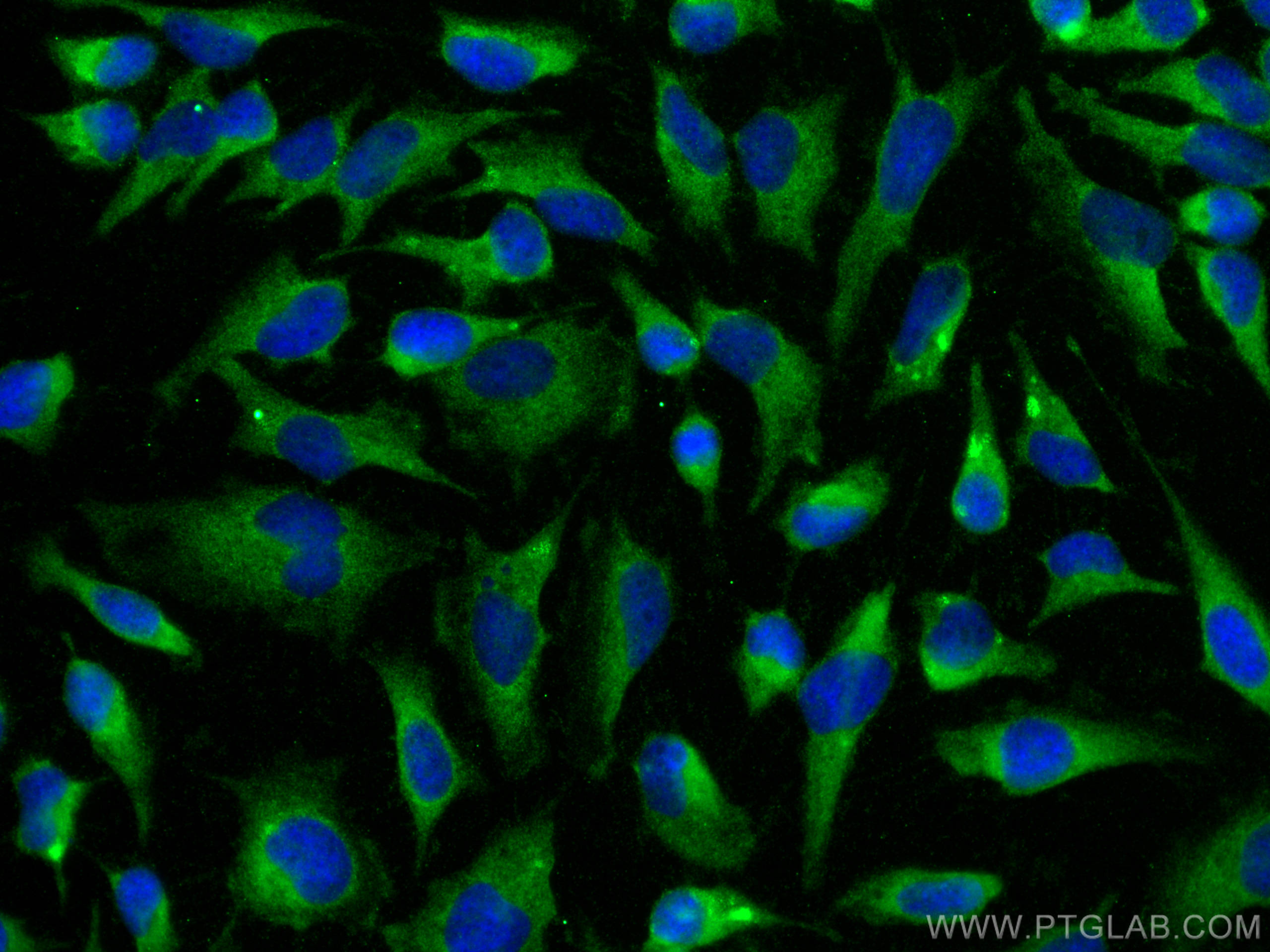 IF Staining of HeLa using 15553-1-AP