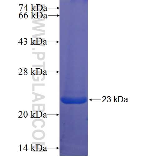 KCTD9 fusion protein Ag22571 SDS-PAGE