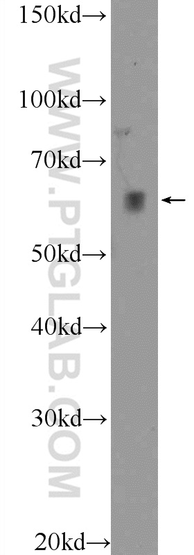 WB analysis of HeLa using 23345-1-AP