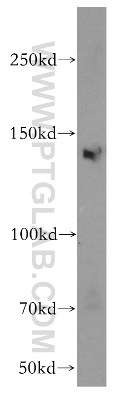 WB analysis of HeLa using 12835-1-AP