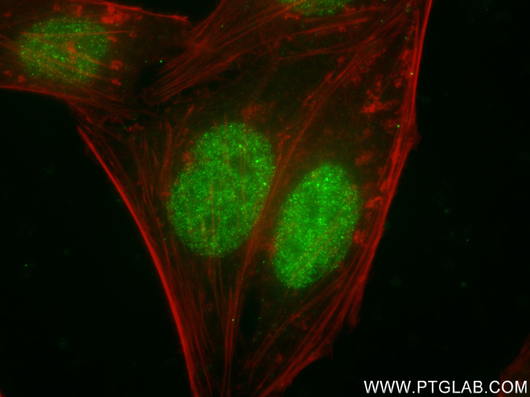 IF Staining of HepG2 using 83571-2-RR (same clone as 83571-2-PBS)