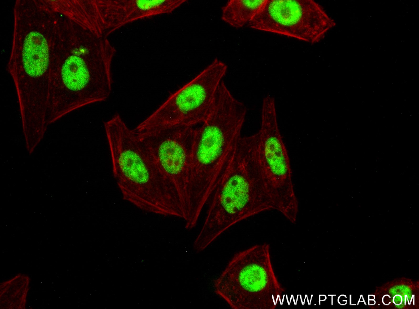 IF Staining of HepG2 using 83571-6-RR (same clone as 83571-6-PBS)