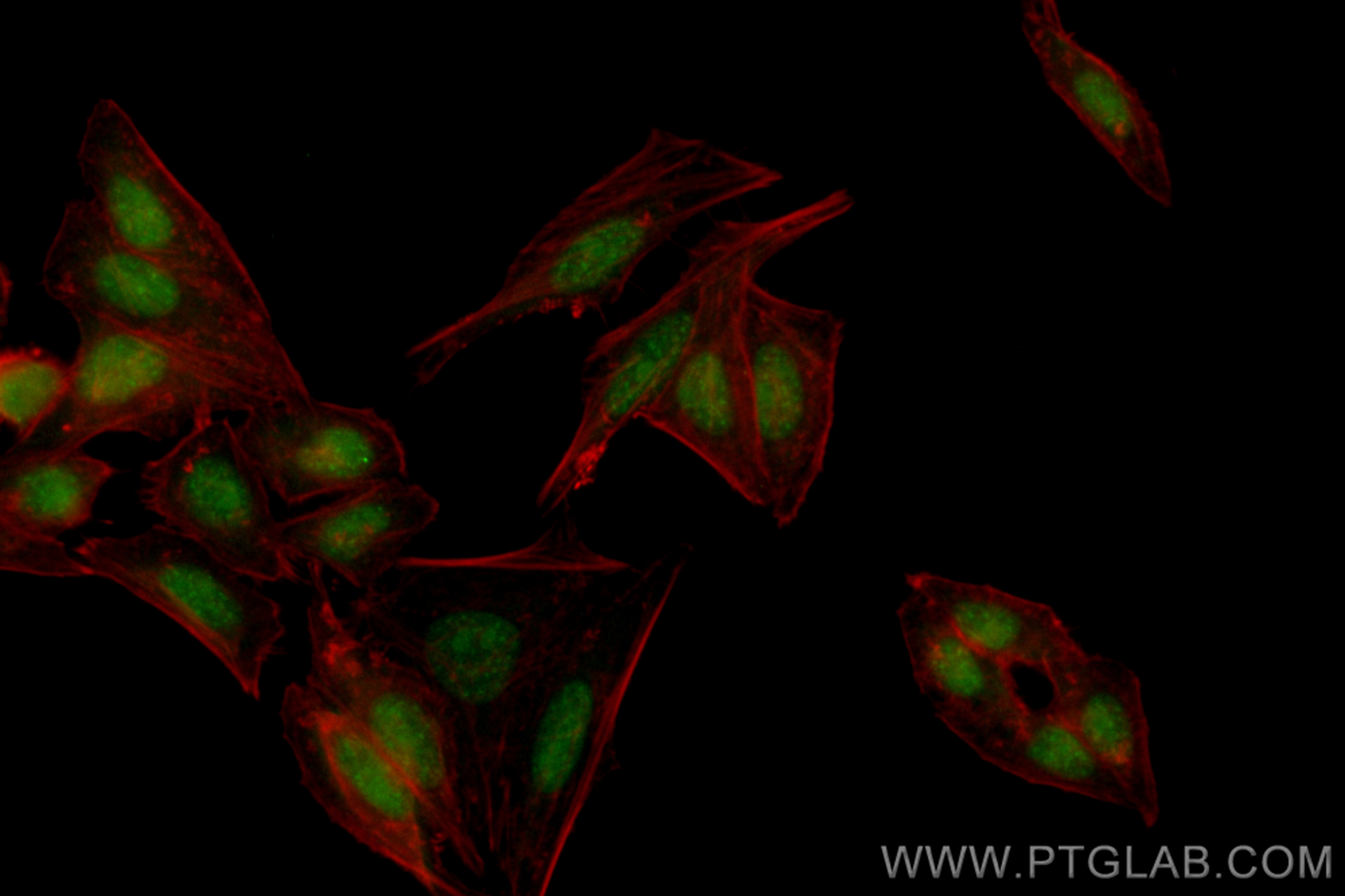 IF Staining of HepG2 using CL488-83571-6