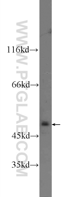 WB analysis of MCF-7 using 24943-1-AP