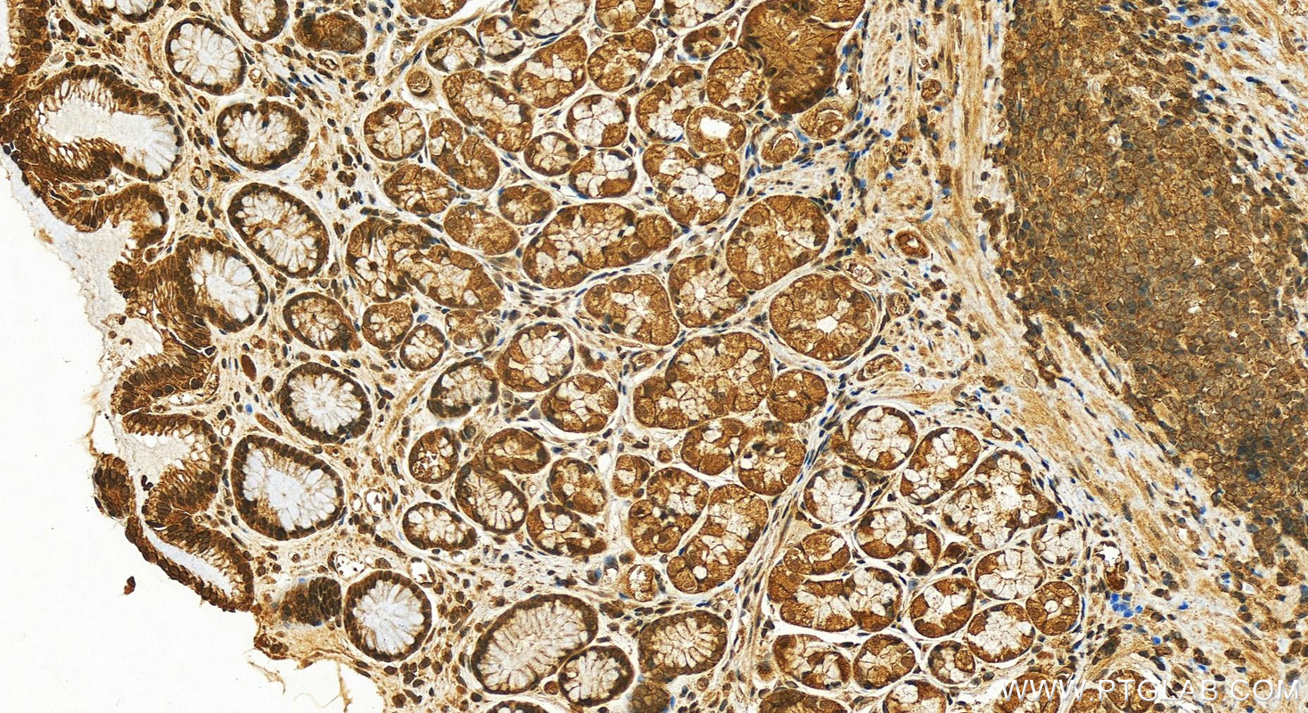 IHC staining of human stomach using 18825-1-AP