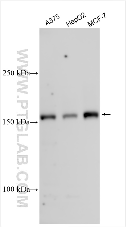 KDM5B