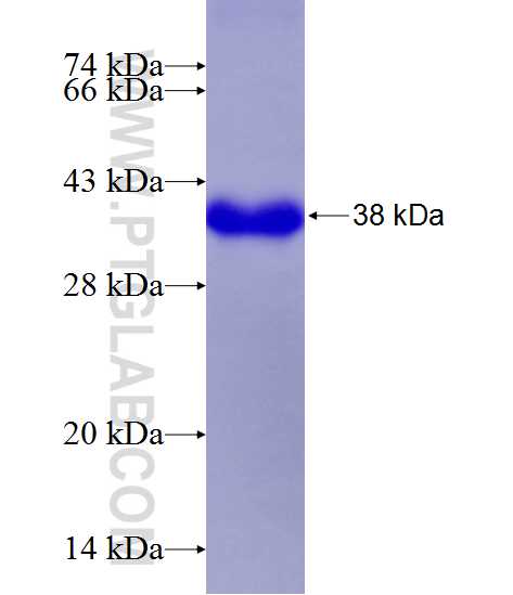 KDR fusion protein Ag24589 SDS-PAGE