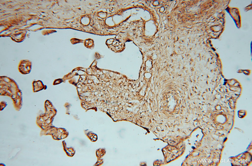 IHC staining of human placenta using 16228-1-AP