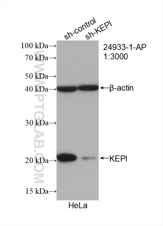 WB analysis of HeLa using 24933-1-AP