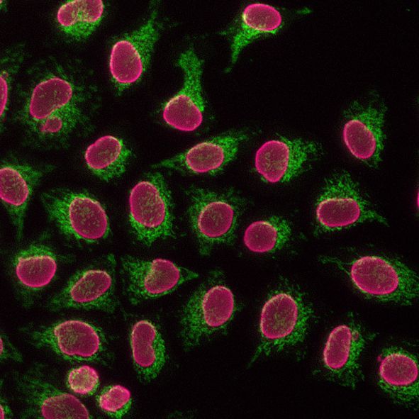 Immunofluorescence of HeLa: PFA-fixed HeLa cells were stained with anti-Tom70 (14528-1-AP) labeled with FlexAble CoraLite® Plus 488 Kit (KFA001, green) and anti-Lamin B1 (12987-1-AP) labeled with FlexAble CoraLite® Plus 647 Kit (KFA003, cyan).​ Epifluorescence images were acquired with a 20x objective and post-processed.