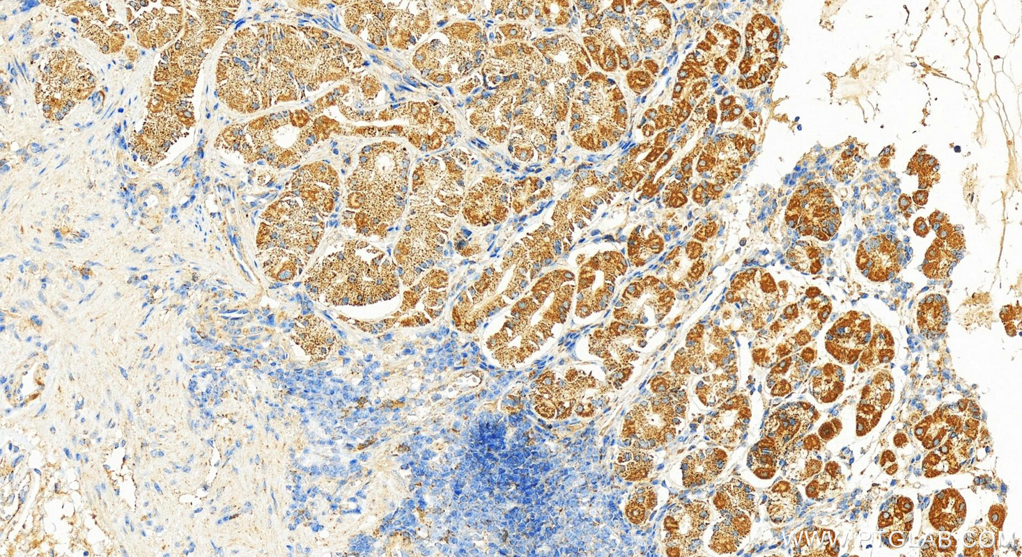 IHC staining of human stomach using 23443-1-AP