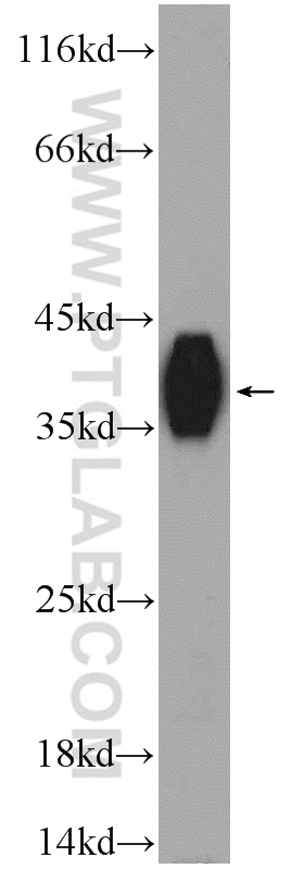 WB analysis of L02 using 23443-1-AP