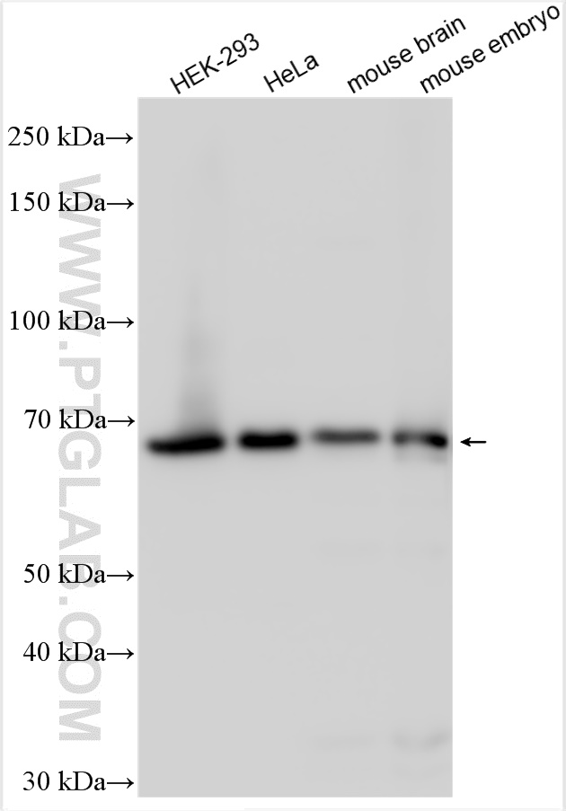 WB analysis using 10222-1-AP