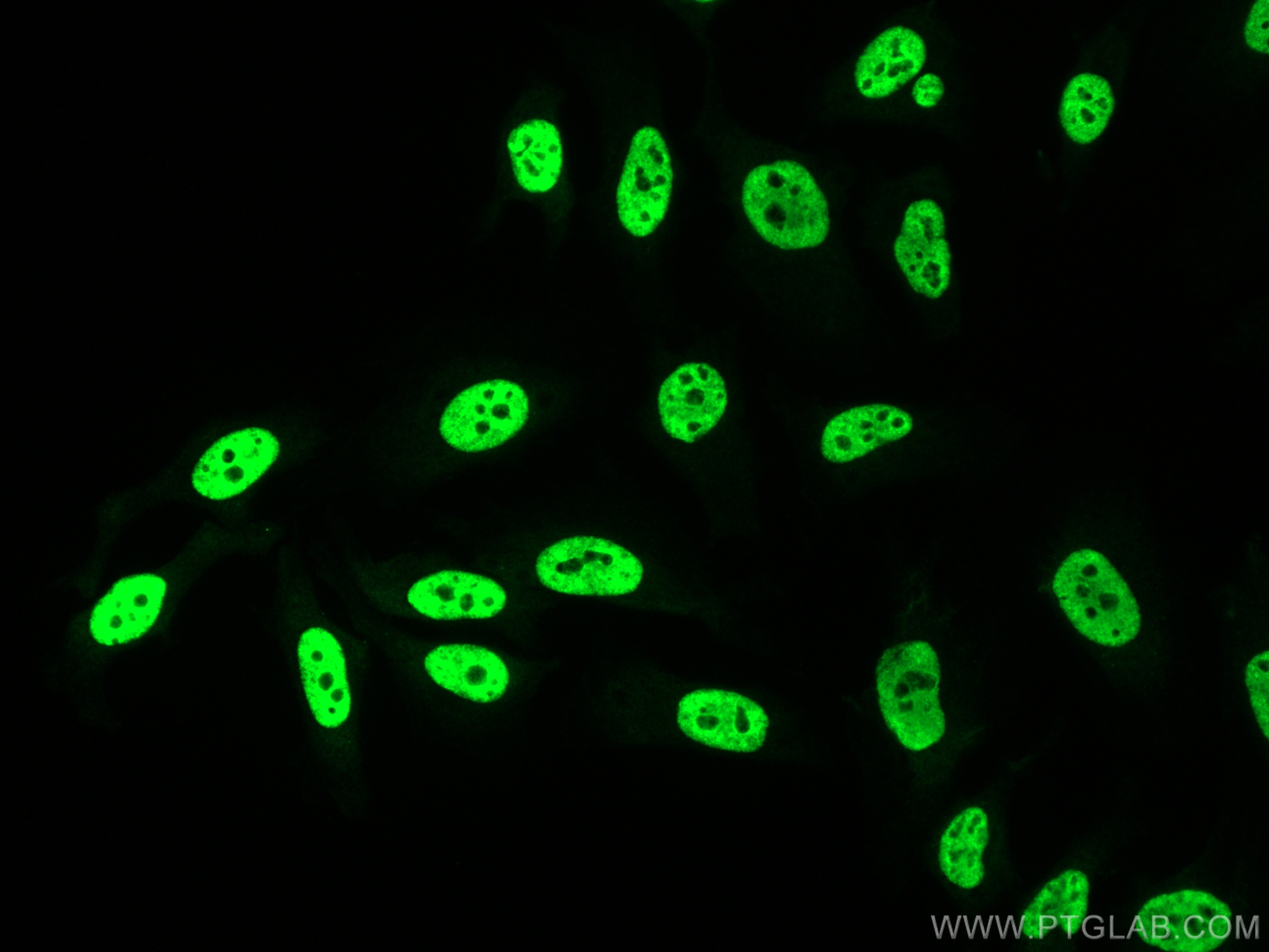 IF Staining of HeLa using 31044-1-AP