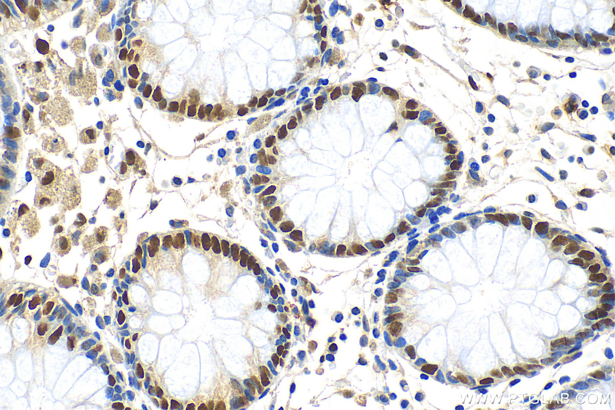 IHC staining of human colon using 31044-1-AP