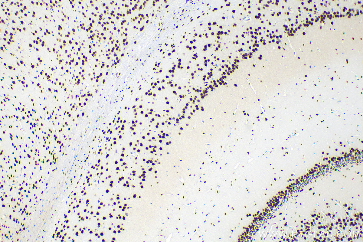 IHC staining of mouse brain using 82931-1-RR