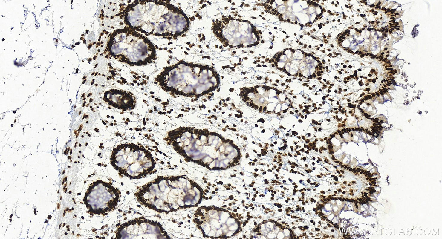 IHC staining of human colon using 82931-3-RR (same clone as 82931-3-PBS)