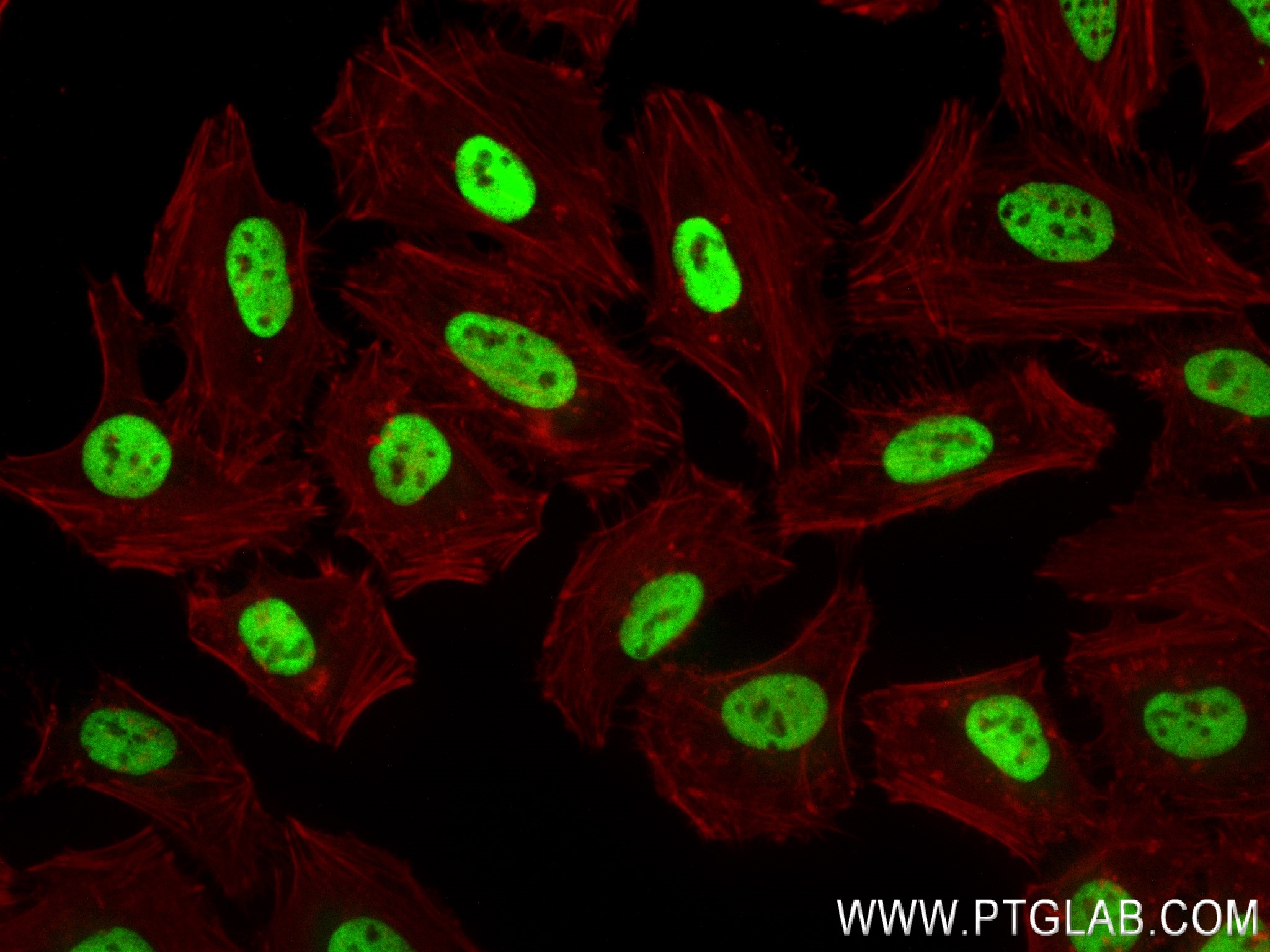 IF Staining of HeLa using 82931-3-RR (same clone as 82931-3-PBS)