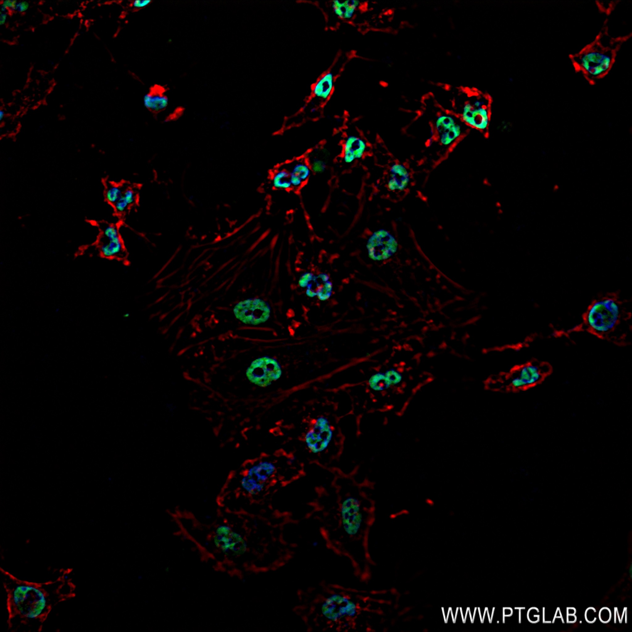 IF Staining of HeLa using 82931-5-RR (same clone as 82931-5-PBS)