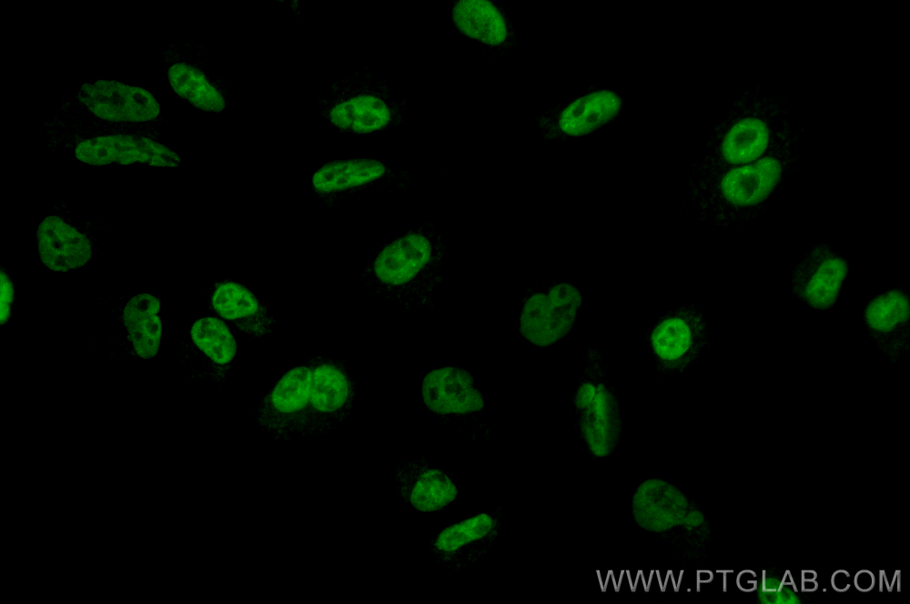 IF Staining of A549 using CL488-82931-3