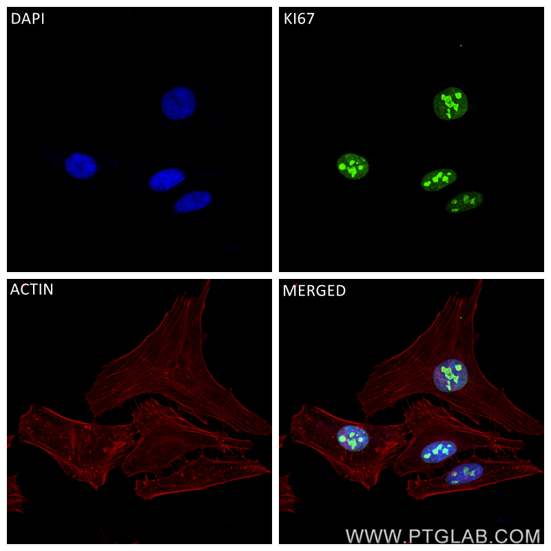 IF Staining of HeLa using 84192-3-RR (same clone as 84192-3-PBS)