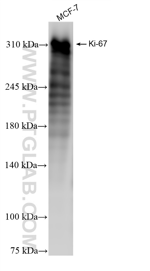 WB analysis of MCF-7 using 84192-3-RR