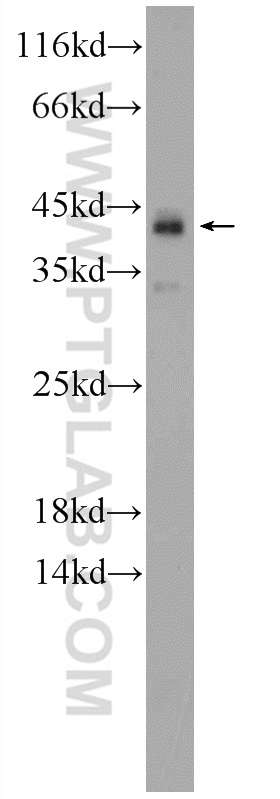 WB analysis of fetal human brain using 24973-1-AP