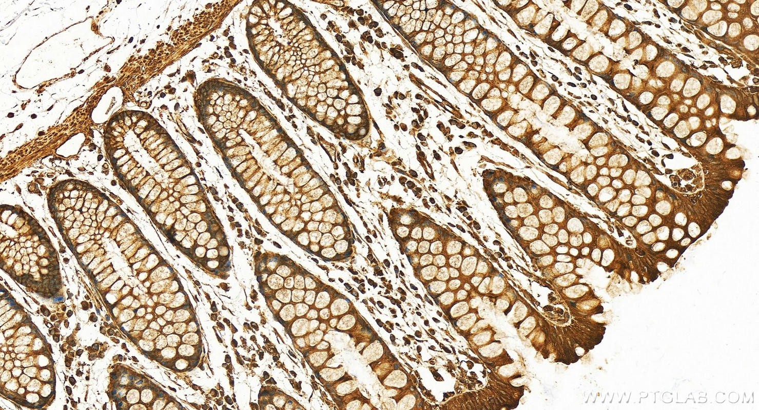 IHC staining of human normal colon using 12345-1-AP