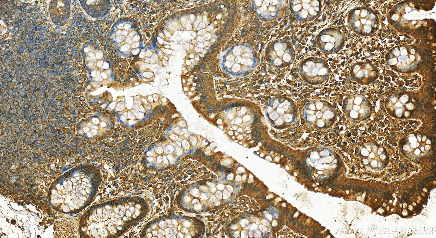 IHC staining of human colon using 12345-1-AP