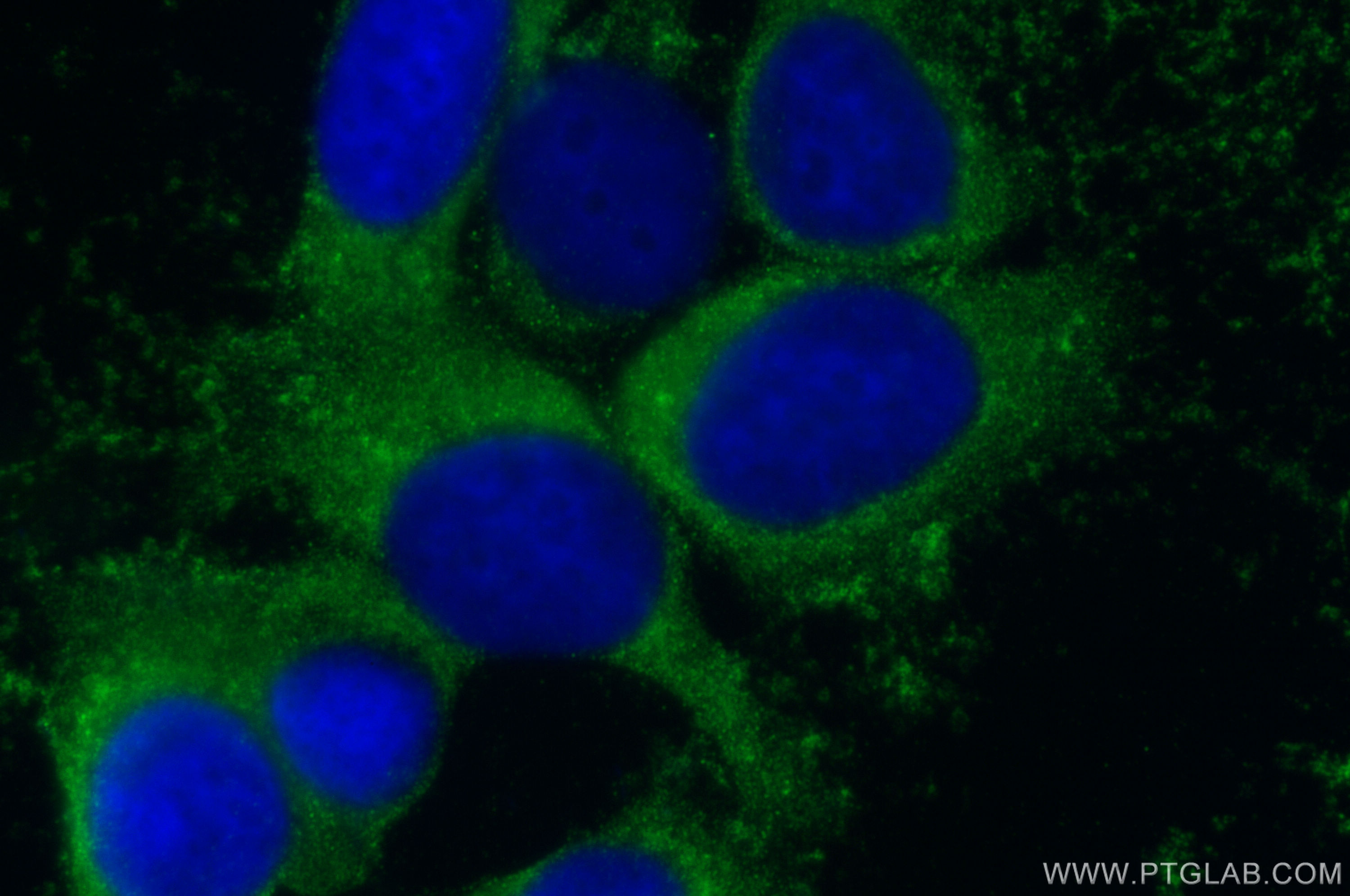 IF Staining of MCF-7 using 12345-1-AP