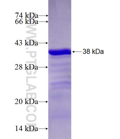 KIAA0649 fusion protein Ag27367 SDS-PAGE