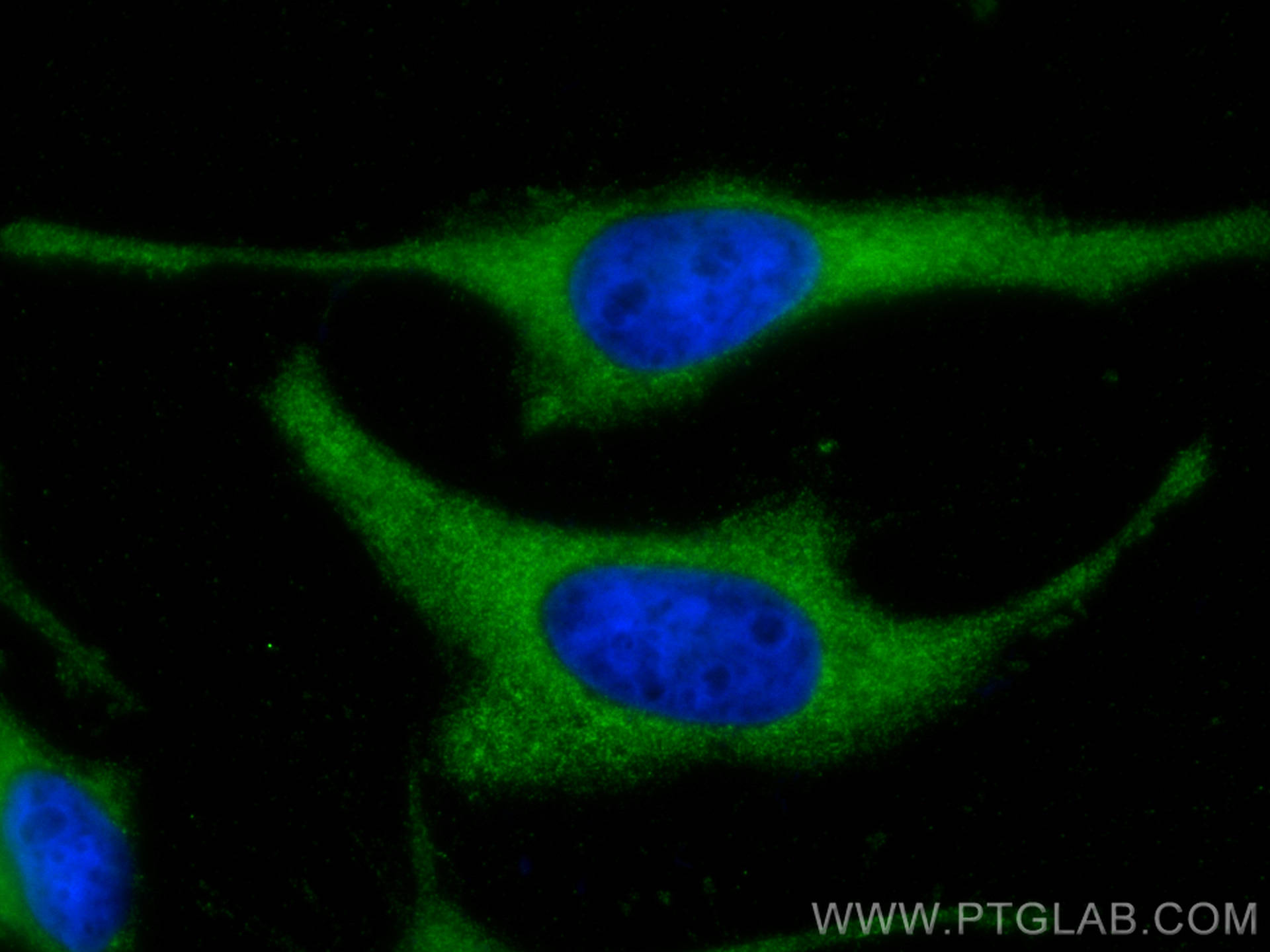 IF Staining of HeLa using 66708-1-Ig (same clone as 66708-1-PBS)