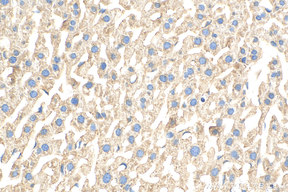 IHC staining of mouse liver using 26087-1-AP