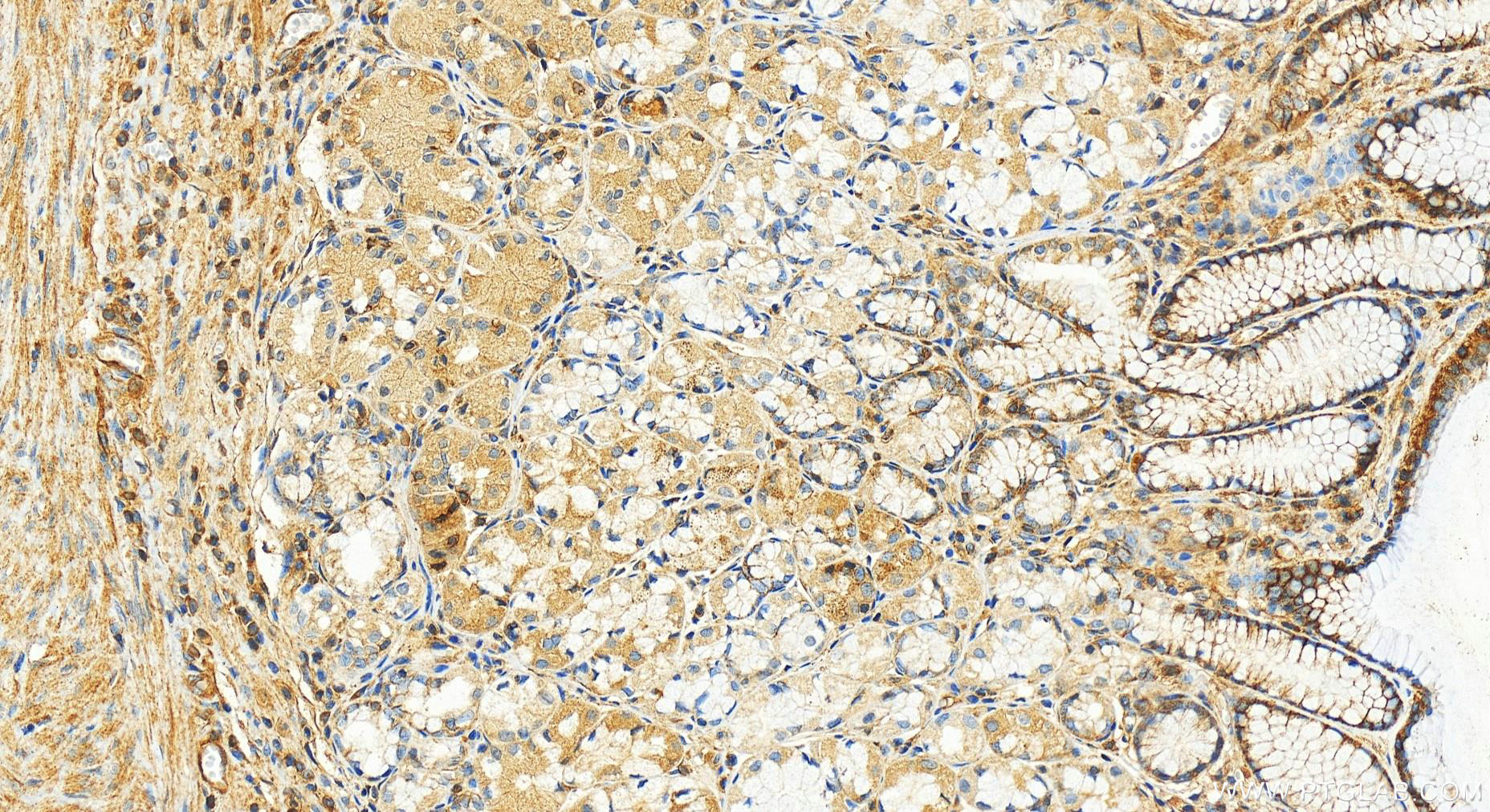 IHC staining of human stomach using 20637-1-AP