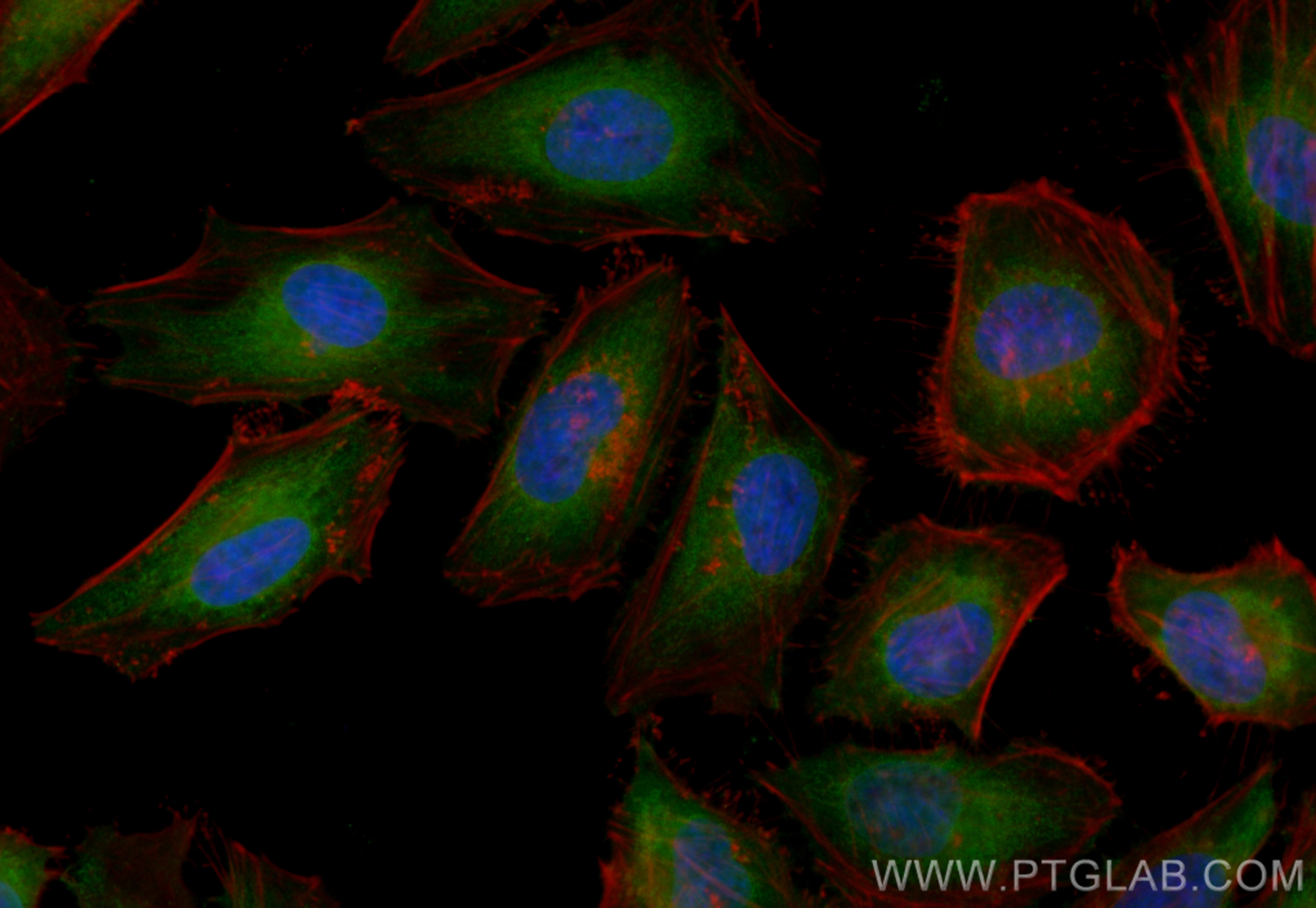 IF Staining of HeLa using CL488-21129