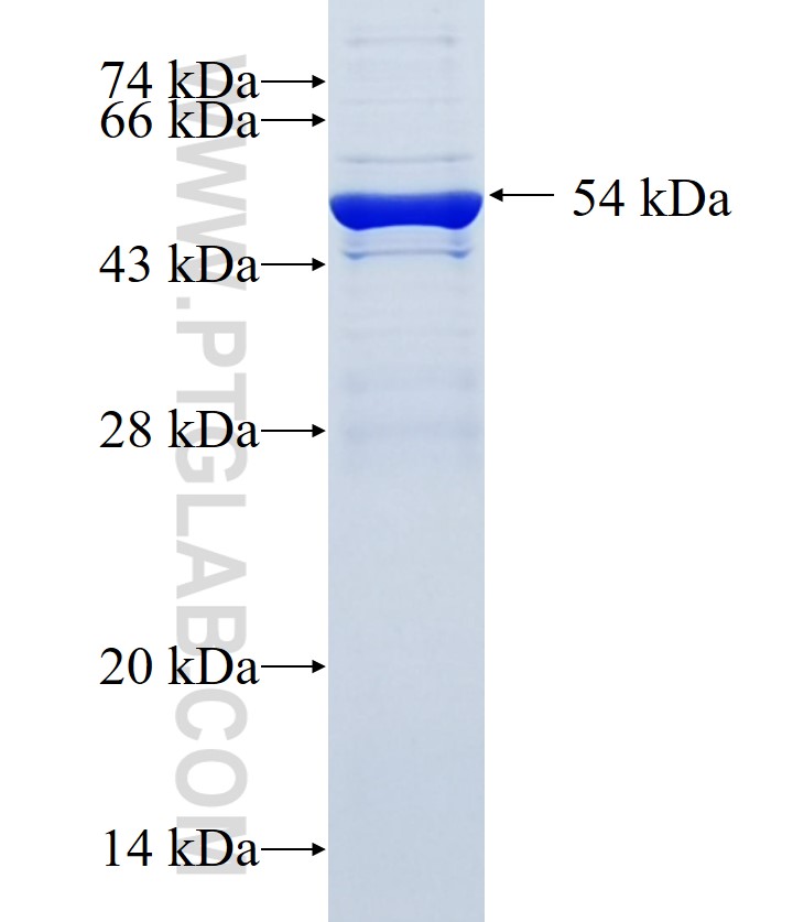 KIAA1199 fusion protein Ag34315 SDS-PAGE